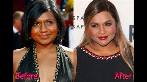 mindy kaling plastic surgery|Mindy Kaling Plastic Surgery: Comparison of Before & After ...